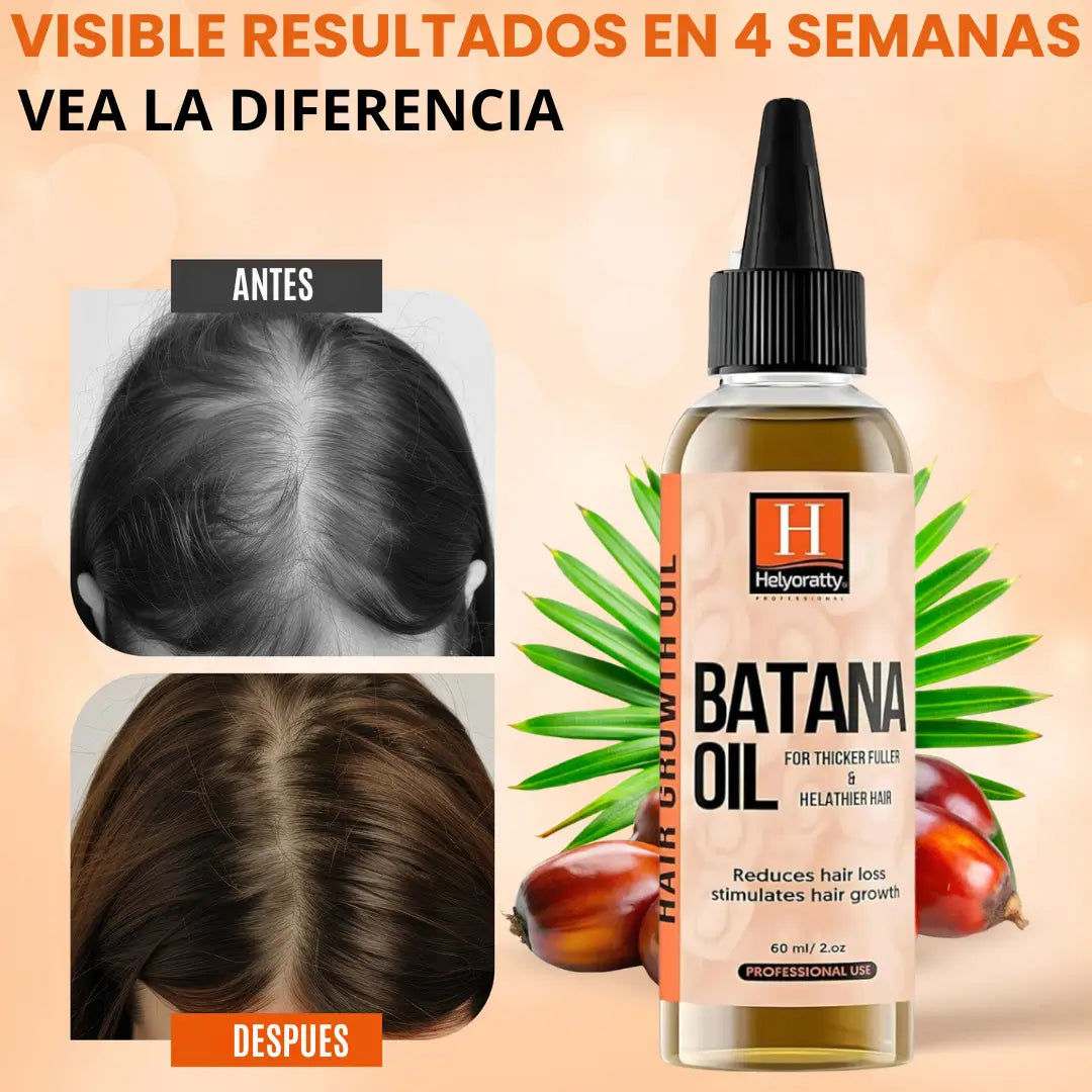 HELYORATTY™ SET DE BATANA (4 EN 1) DETIENE LA CAIDA Y  RECUPERA EL CRECIMIENTO EN 4 SEMANAS